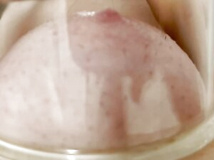 Nipple sucker